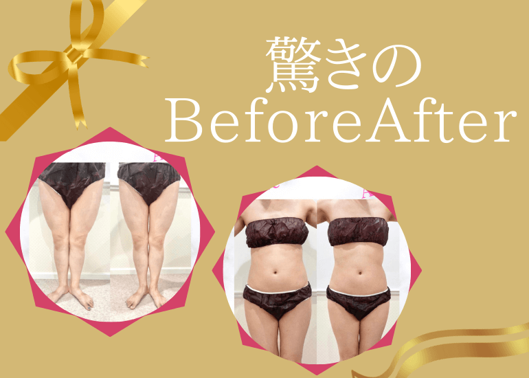 そのダイエット、今すぐやめて！！ 茗荷谷 本郷三丁目 春日の人気美容室 Beautism【ビュの外観
